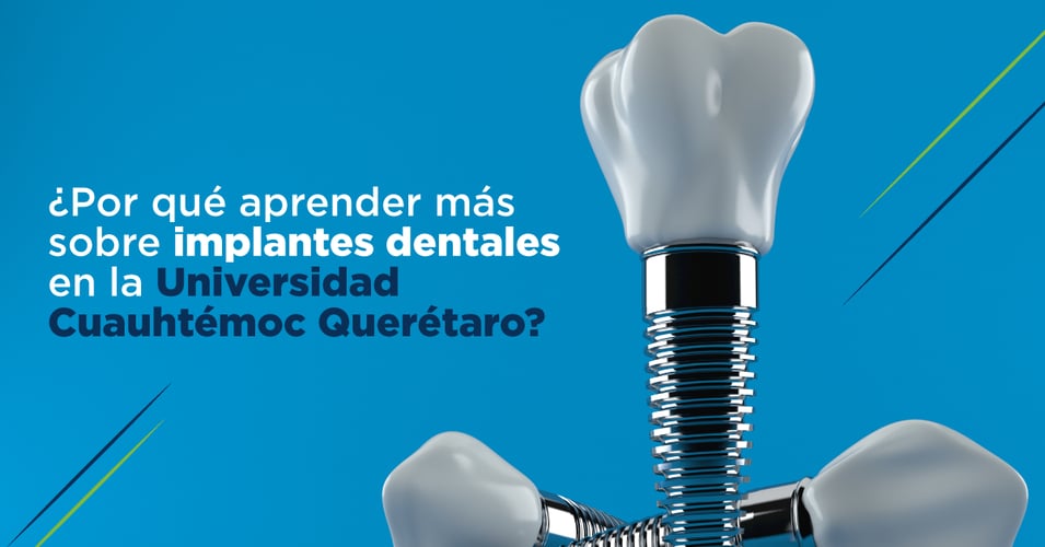 ¿Por qué aprender más sobre implantes dentales en la Universidad Cuauhtémoc Querétaro?